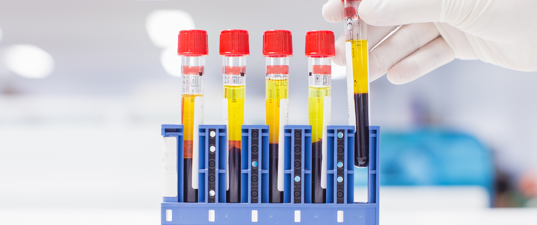 Why Dr. Passero Checks Every Patient’s Vitamin D Level