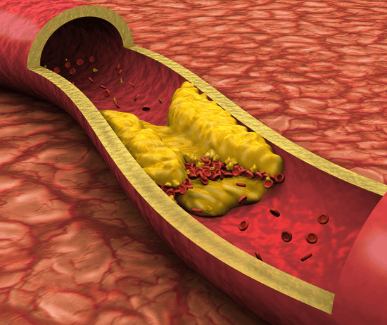 Red Yeast Rice for Cholesterol: A Doctor’s Guide to Benefits, Uses & Side Effects