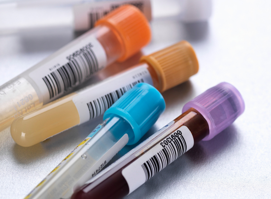 Lab Test Used Durable LAB TESTS